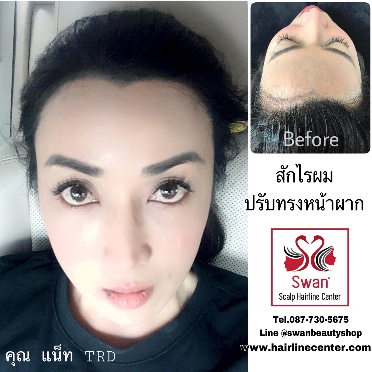 My Image 24