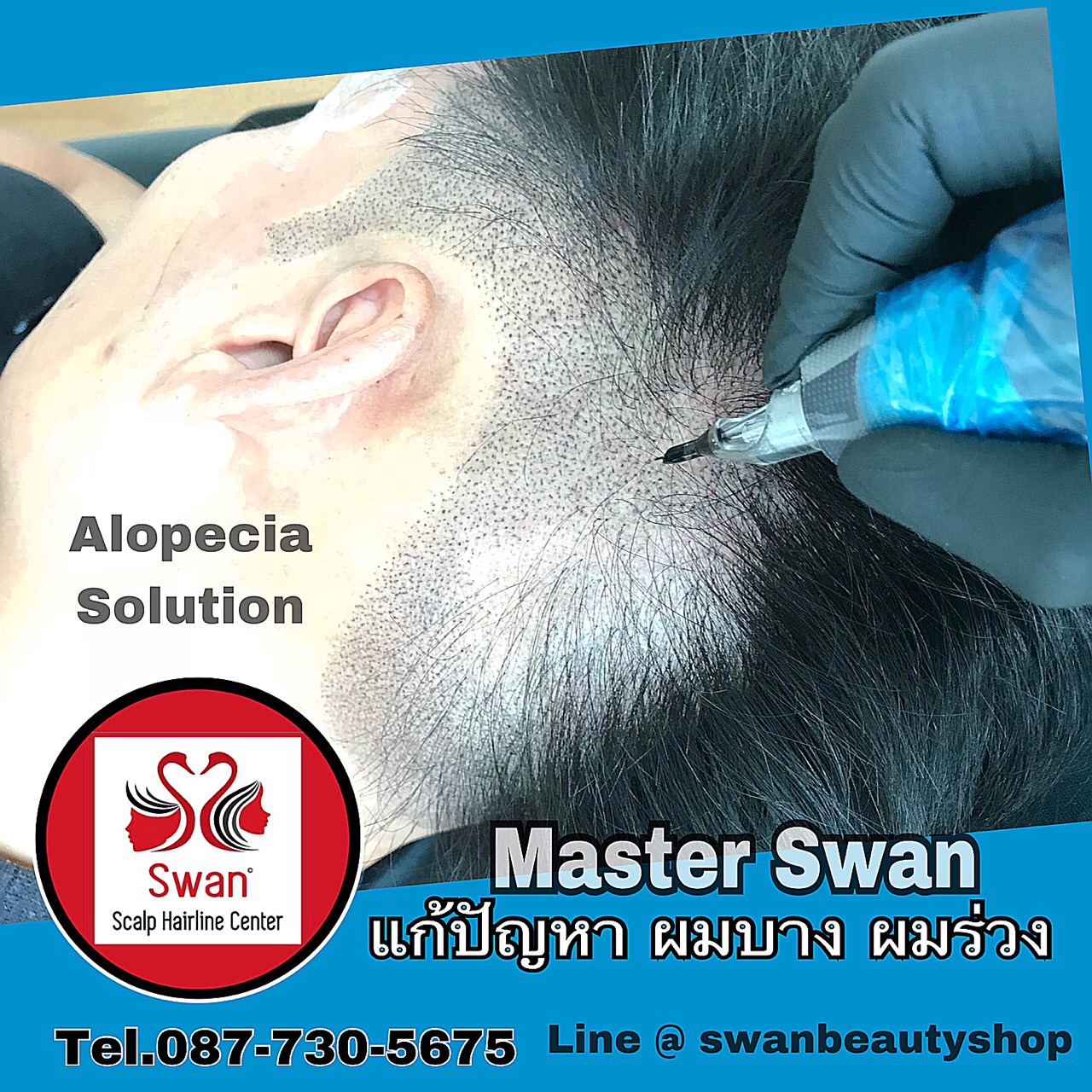 รู้ก่อนสักไรผม01