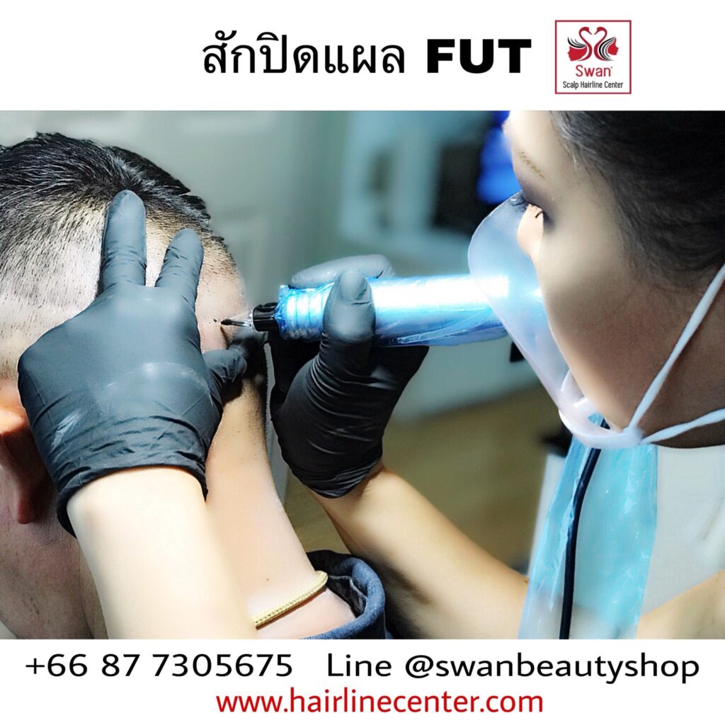 รู้ก่อนสักไรผม03