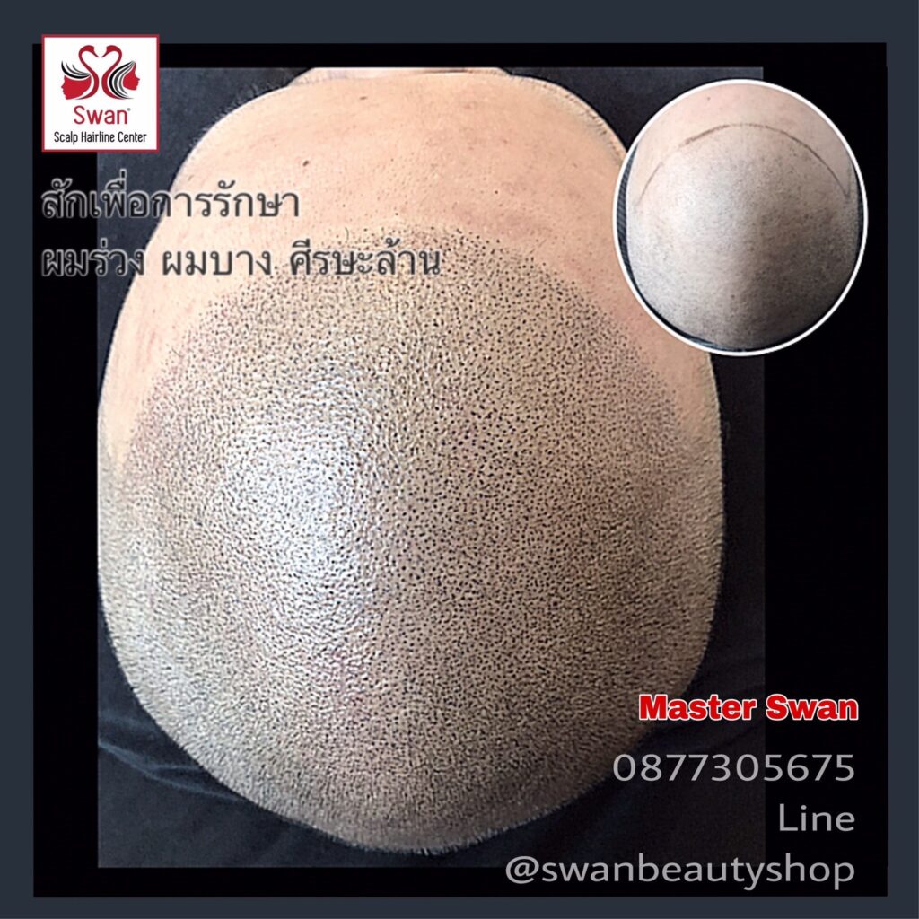 รู้ก่อนสักไรผม05